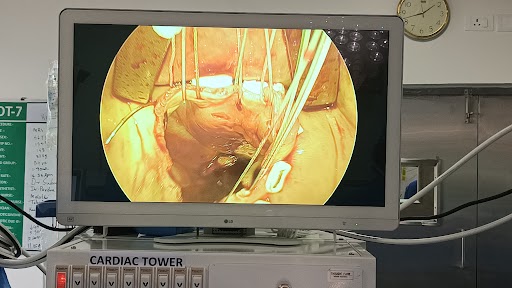 Acute massive PE with cardiogenic shock